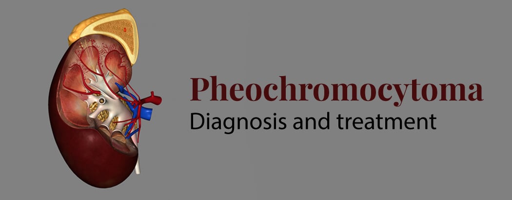 Pheochromocytoma: Causes, Symptoms, Diagnosis and Treatment Pheochromocytoma: Causes, Symptoms, Diagnosis and Treatment