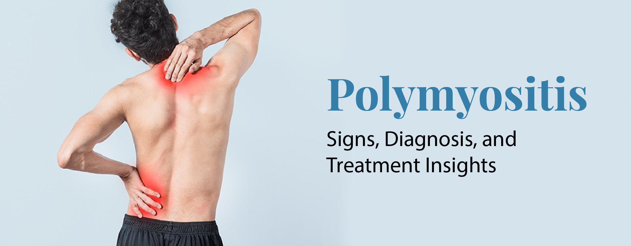 Polymyositis: Signs, Diagnosis, and Treatment Insights
