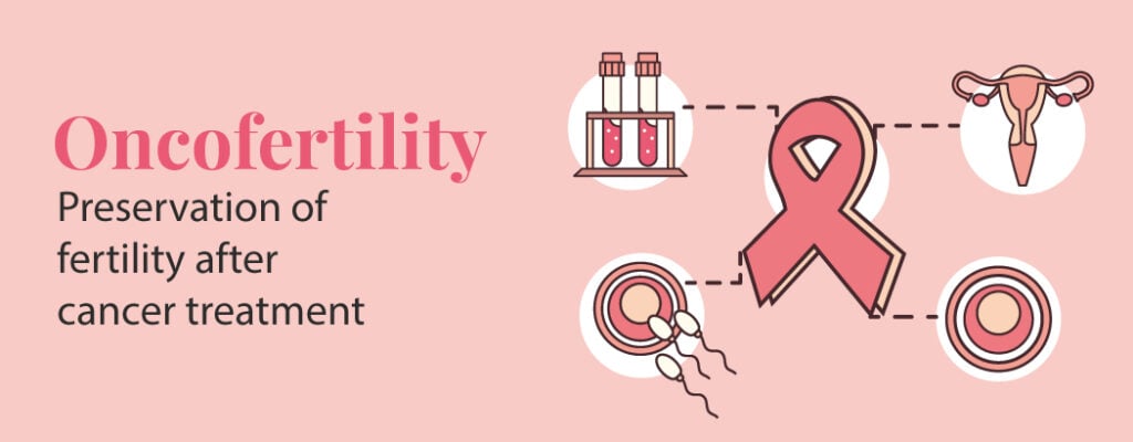Oncofertility – Preservation of Fertility After Cancer Treatment