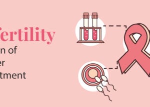 Oncofertility – Preservation of Fertility After Cancer Treatment