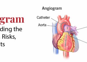 Angiogram: Understanding the Procedure, Risks, and Benefits