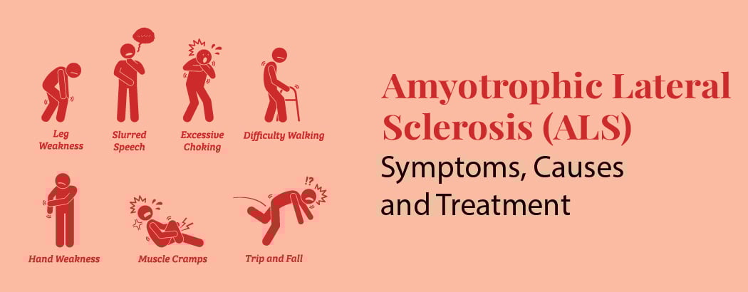 Amyotrophic Lateral Sclerosis (ALS): Symptoms, Causes and Treatment