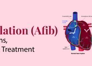 Atrial Fibrillation (Afib): Symptoms, Causes and Treatment