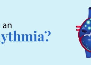 What is an Arrhythmia?