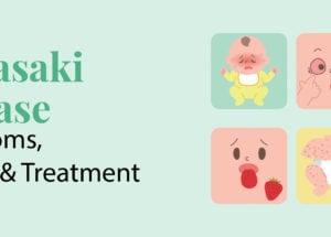 Kawasaki Disease: Symptoms, Causes and Treatment