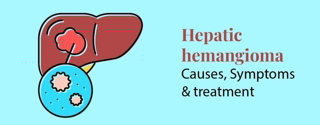 Hepatic Hemangioma: Causes, Symptoms & Treatment