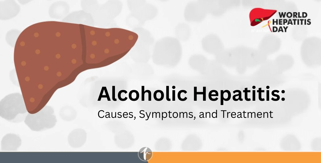 Alcoholic Hepatitis: Causes, Symptoms, and Treatment
