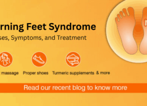 Burning Feet Syndrome: Causes, Symptoms, and Treatment