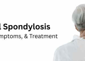 Cervical Spondylosis: Causes, Symptoms, and Treatment