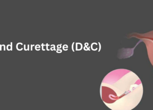 Dilation and Curettage (D&C): Overview, Recovery, and Care