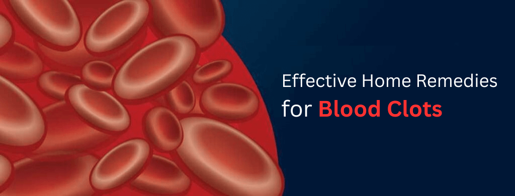 Effective Home Remedies for Blood Clots Effective Home Remedies for Blood Clots