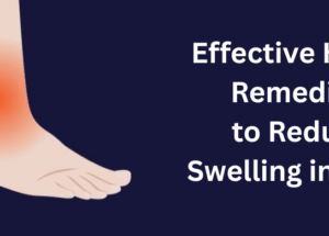 Effective Home Remedies to Reduce Swelling in Feet