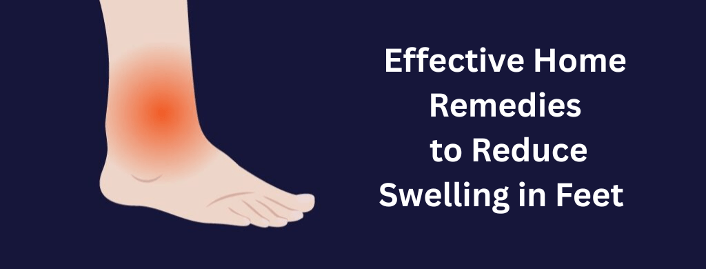 Effective Home Remedies to Reduce Swelling in Feet
