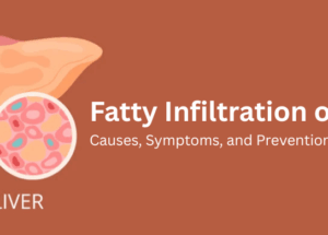 Fatty Infiltration of the Liver: Causes, Symptoms, and Prevention