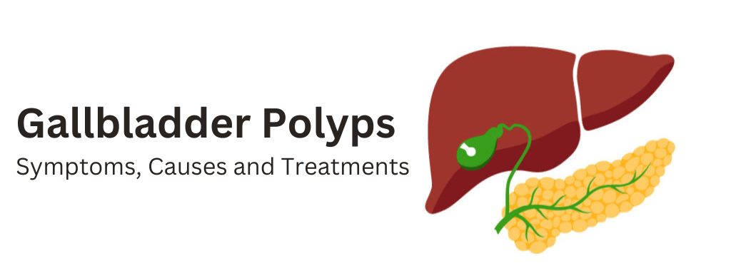 Gallbladder Polyps: Symptoms, Causes and Treatments