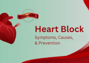 Heart Block: Symptoms, Causes, and Prevention