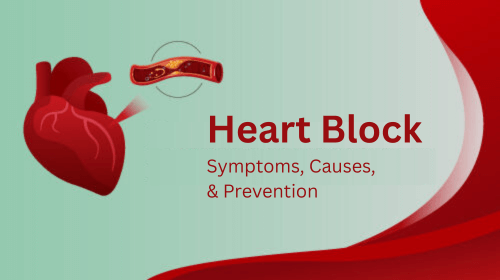 Heart Block: Symptoms, Causes, and Prevention Heart Block: Symptoms, Causes, and Prevention