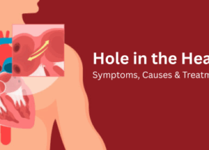 Hole in the Heart – Symptoms, Causes & Treatment