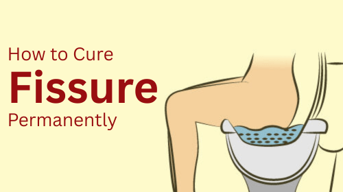How to Cure Fissure Permanently How to Cure Fissure Permanently