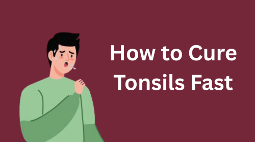 How to Cure Tonsils Fast How to Cure Tonsils Fast