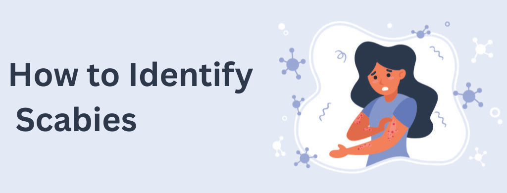How to Identify Scabies How to Identify Scabies