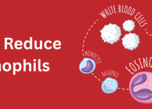 Eosinophilia: Causes, Symptoms, and How to Reduce Eosinophil