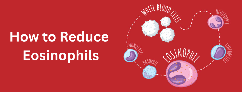 Eosinophilia: Causes, Symptoms, and How to Reduce Eosinophil Eosinophilia: Causes, Symptoms, and How to Reduce Eosinophil