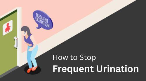 How to Stop Frequent Urination