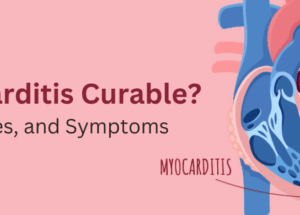 Is Myocarditis Curable? Signs, Causes, and Symptoms