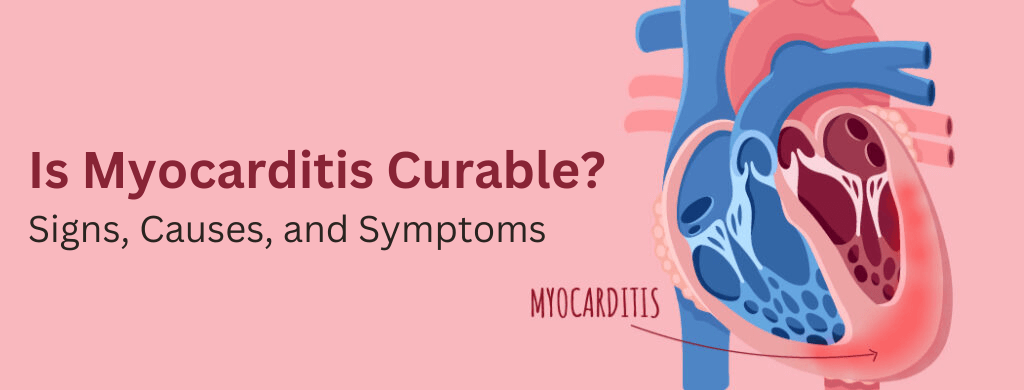 Is Myocarditis Curable? Signs, Causes, and Symptoms Is Myocarditis Curable? Signs, Causes, and Symptoms