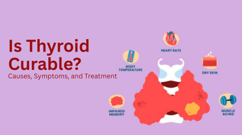 Is Thyroid Curable? Causes, Symptoms, and Treatment Options
