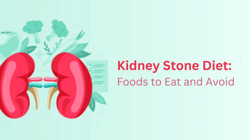 Kidney Stone Diet: Foods to Eat and Avoid Kidney Stone Diet: Foods to Eat and Avoid