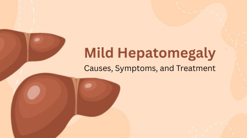 Mild Hepatomegaly: Causes, Symptoms, and Treatment