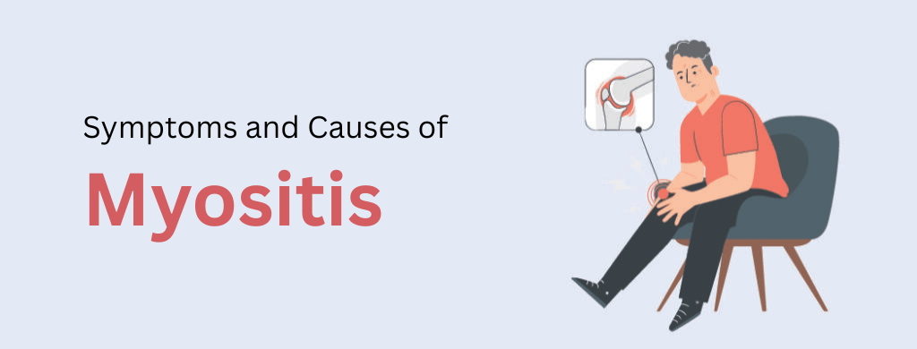 Myositis: Types, Symptoms, Causes, and Treatment Myositis: Types, Symptoms, Causes, and Treatment