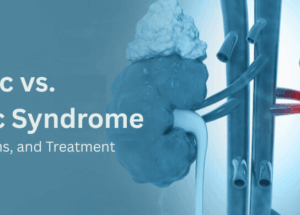 Nephrotic vs Nephritic Syndrome: Causes, Symptoms, and Treatment