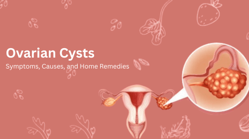 Ovarian Cysts: Symptoms, Causes, and Home Remedies