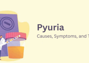 صديد البول: الأسباب والأعراض والعلاج