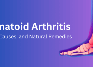 Rheumatoid Arthritis: Symptoms, Causes, and Natural Remedies