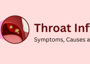 Throat Infection: Symptoms, Causes and Treatment