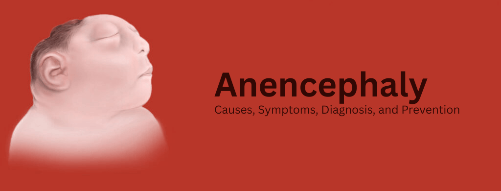 Anencephaly: Causes, Symptoms, Diagnosis, and Prevention