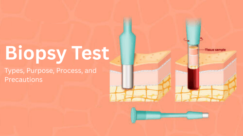 Biopsy Test: Types, Purpose, Process, and Precautions Biopsy Test: Types, Purpose, Process, and Precautions