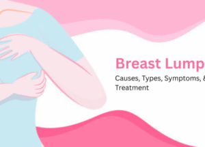 Breast Lumps: Causes, Types, Symptoms, & Treatment