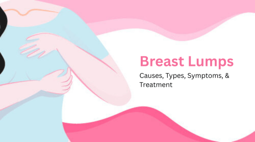 Breast Lumps: Causes, Types, Symptoms, & Treatment Breast Lumps: Causes, Types, Symptoms, & Treatment