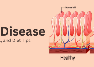 Celiac Disease: Causes, Symptoms, and Diet Tips