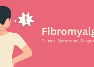 Fibromyalgia: Causes, Symptoms, Diagnosis, and Treatment