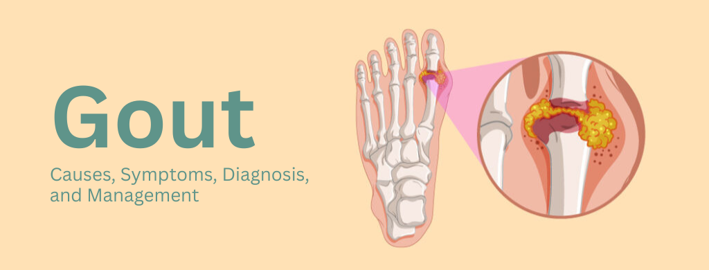 Gout: Causes, Symptoms, Diagnosis, and Management
