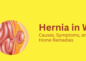 Hernia in Women: Causes, Symptoms, and Home Remedies