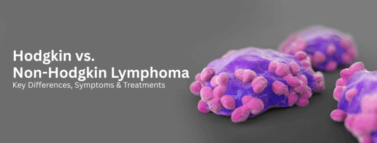 Hodgkin vs. Non-Hodgkin Lymphoma: Key Differences, Symptoms & Treatments