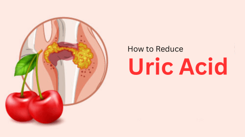 How to Reduce Uric Acid Naturally How to Reduce Uric Acid Naturally