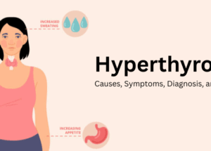 Hyperthyroidism: Causes, Symptoms, Diagnosis, and Treatment